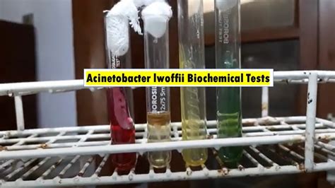 acinetobacter biochemical test|acinetobacter lwoffii biochemical tests.